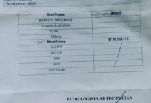 Photo of अवैध नर्सिंग होम और अवैध पैथेलाजी लैब का हब बना बैरिया तहसील